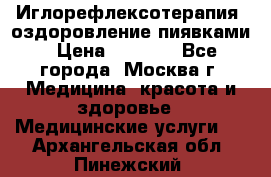 Иглорефлексотерапия, оздоровление пиявками › Цена ­ 3 000 - Все города, Москва г. Медицина, красота и здоровье » Медицинские услуги   . Архангельская обл.,Пинежский 